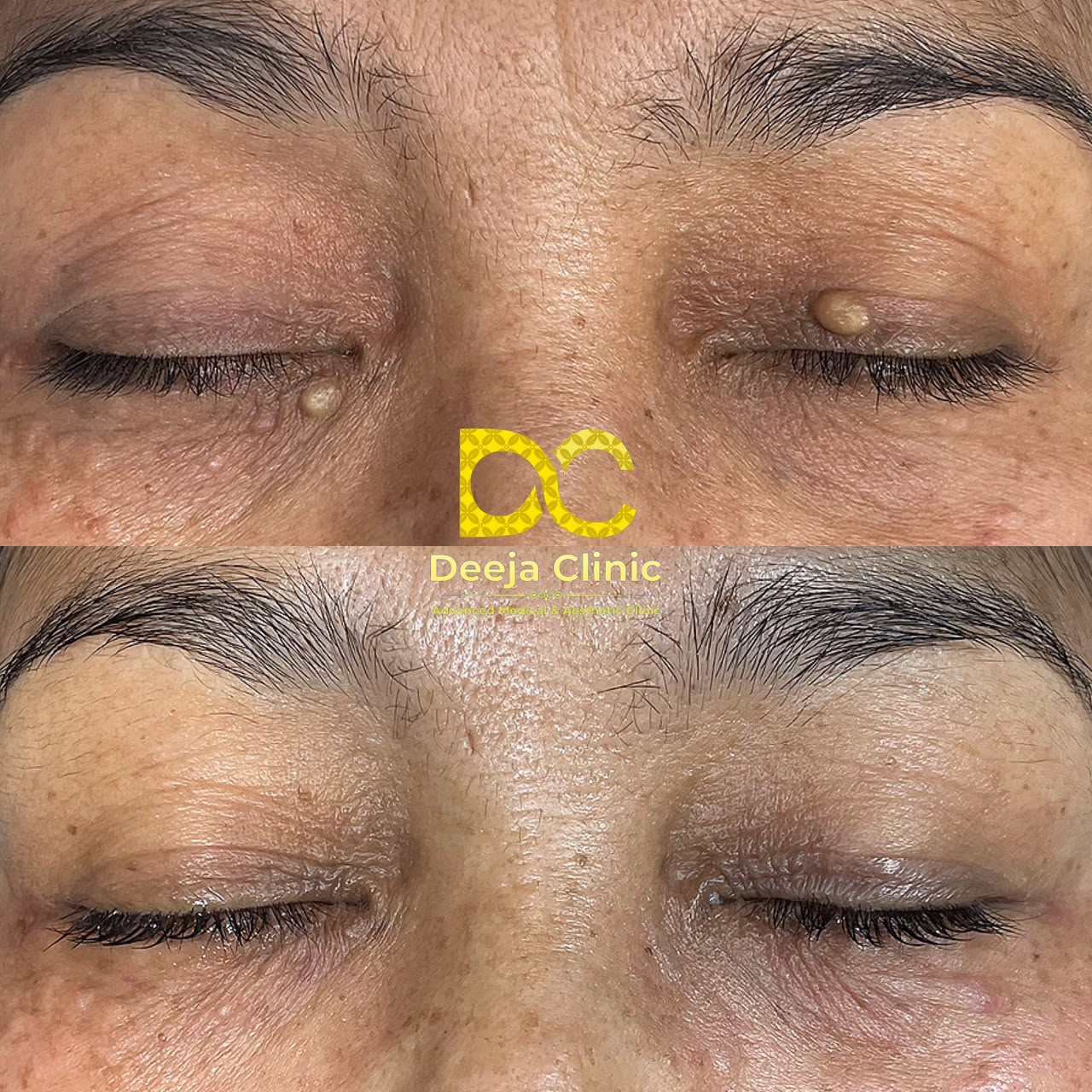 Hasil Treatment